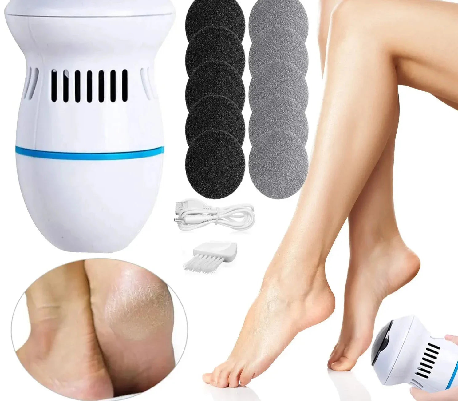 Electric foot remover for calluses