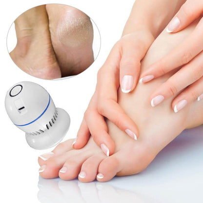 Electric foot remover for calluses