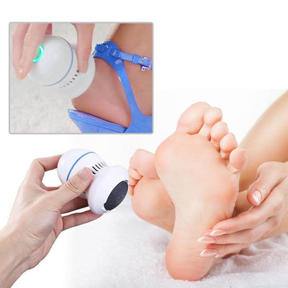 Electric foot remover for calluses