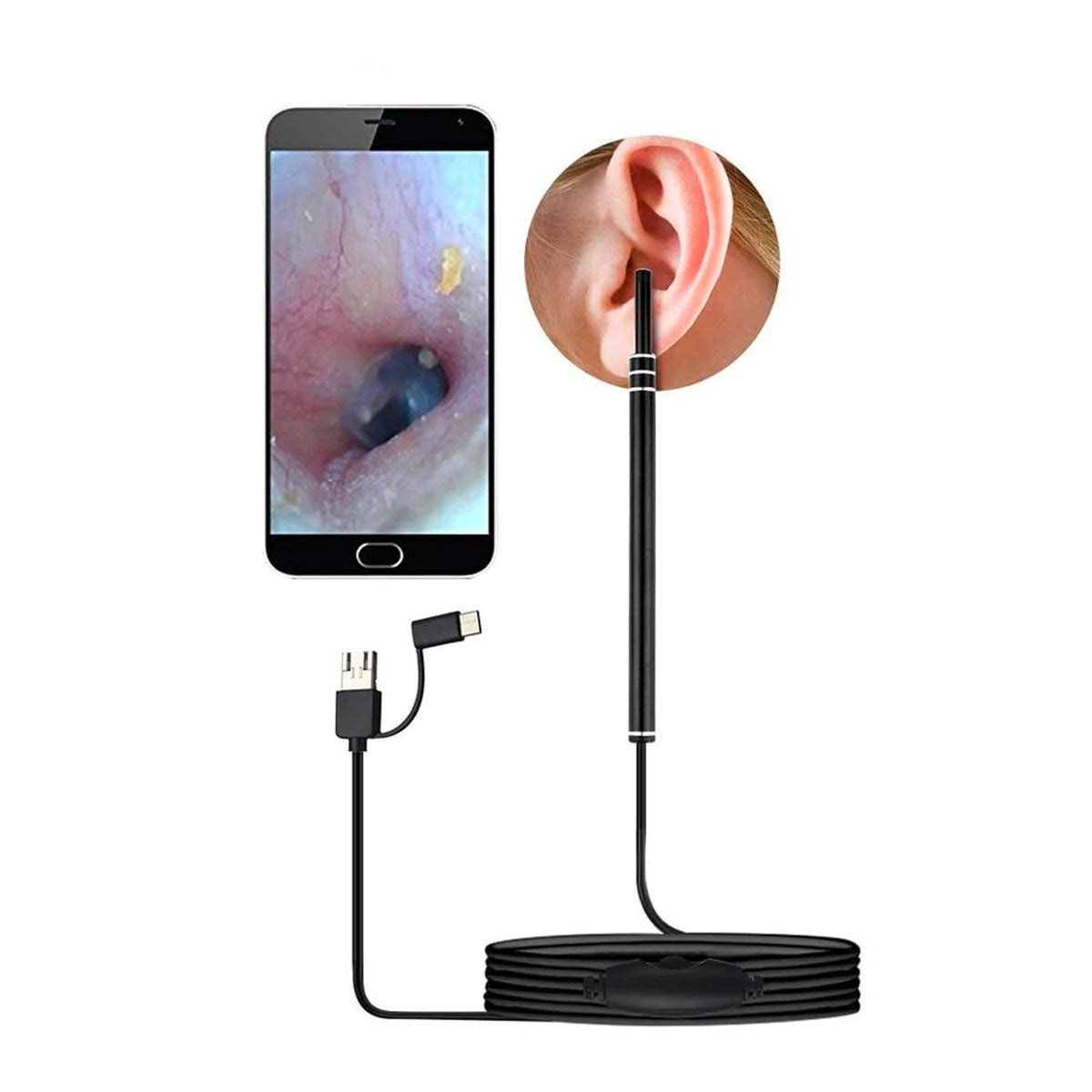 Live Ear Medical ear endoscope.