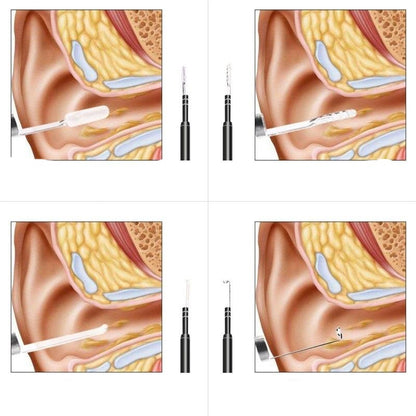 Live Ear Medical ear endoscope.