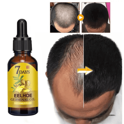 Natural Ginger Hair Growth Oil
