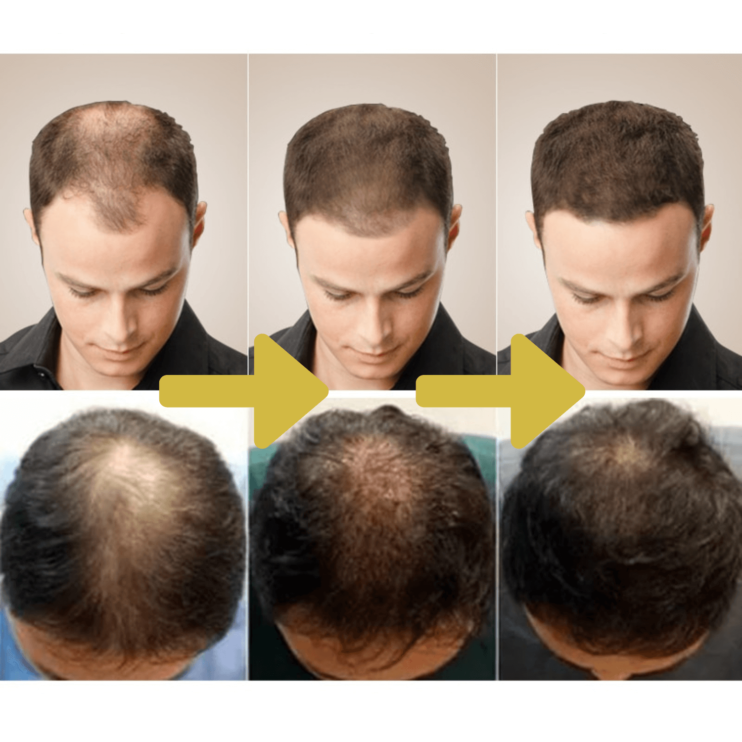 Natural Ginger Hair Growth Oil