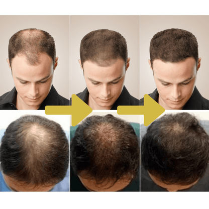 Natural Ginger Hair Growth Oil